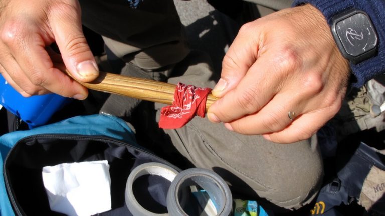 splint and stabilize carefully
